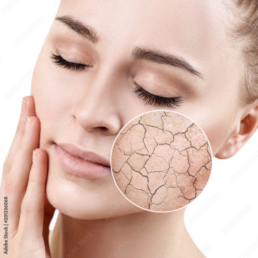 Peau déshydratée - C&C Salon esthétique